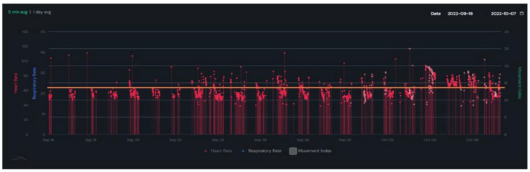 Heart rate, three weeks in one room